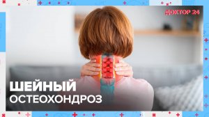 ШЕЙНЫЙ ОСТЕОХОНДРОЗ | Доктор 24