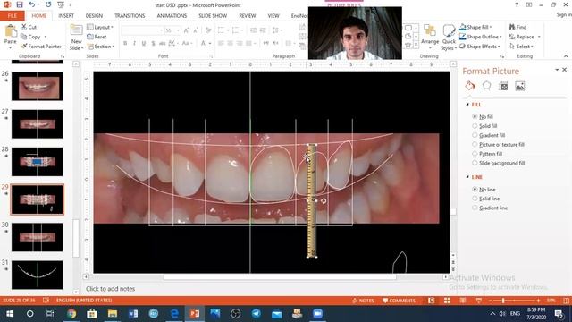 Digital Smile Design on Power Point By Dr. Amr Abouzeid (in Arabic)