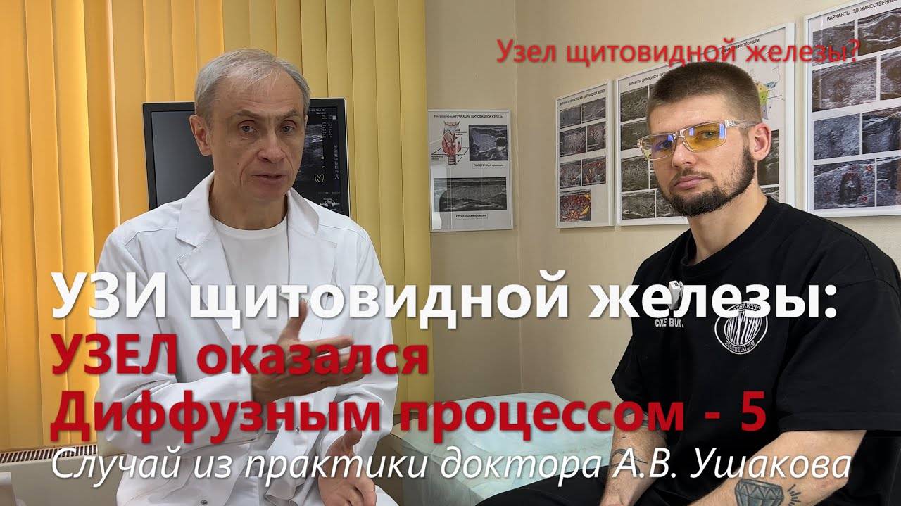 УЗИ щитовидной железы: Как узисты приняли сегмент за Узел // Доктор Ушаков смотреть онлайн