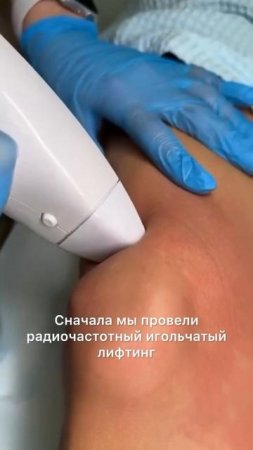 13 января 2025 г.