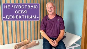 «После ампутации не чувствую себя дефектным»