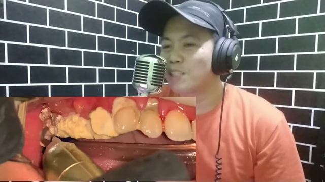 How to Remove TARTAR? (Reaction Video by DJ Ingua.) смотреть онлайн