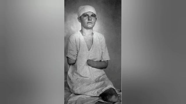ЕЁ ИСКАЛЕЧИЛА ВОЙНА. ОНА ПОТЕРЯЛА РУКИ И НОГИ И НЕ НА СЕКУНДУ НЕ СДАЛАСЬ..