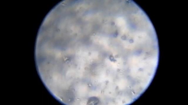 Наталья Ушакова. Часть 20. Микробы смотреть онлайн