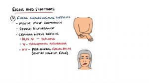 Cerebral Venous Sinus Thrombosis (CVST) | With Dural Venous Sinuses Anatomy