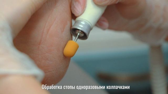 Педикюр смотреть онлайн