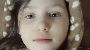Перекись палец Сухая мазоль нога
