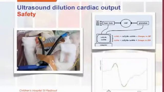 18   Ultrasound delution cardiac output De Boode (2009)
