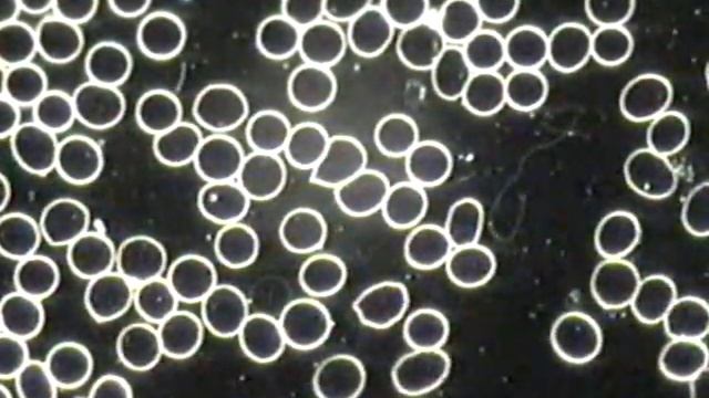 Live Blood Cells Phase Shift