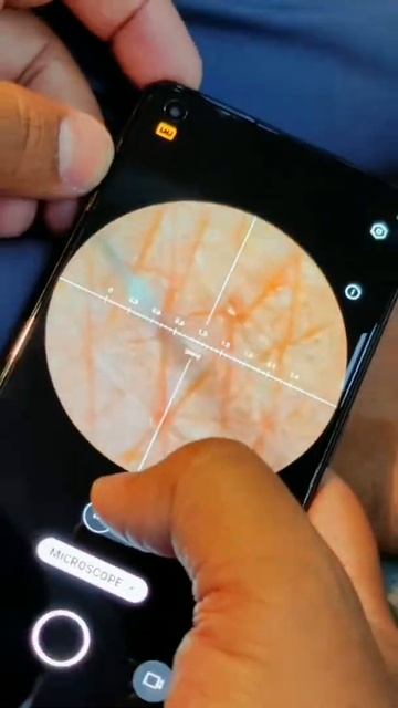 World Microscope camera phone #realme #shorts смотреть онлайн