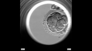 Развитие эмбриона до стадии бластоцисты. Видео из time-lapse системы EmbryoScope