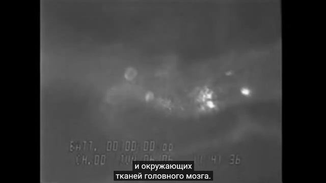 Куркума лечит артрит и инсульт смотреть онлайн