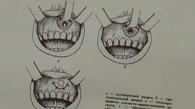 Создание и внедрение продуктов методического обеспечения нового поколения смотреть онлайн