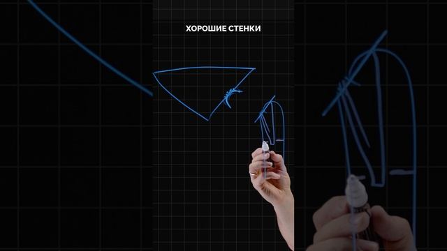 Эндопротез - протез бедра