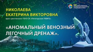 32  Аномальный венозный легочный дренаж   Николаева Екатерина Викторовна