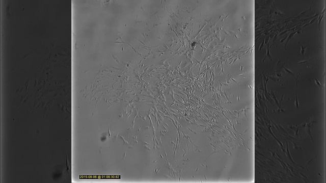 Proliferation of human mesenchymal stem cells printed on the glass slide смотреть онлайн