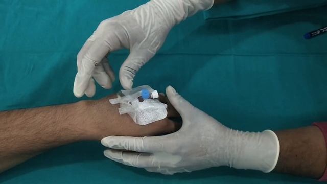 iv cannula removal procedure  | Live Procedure Of Iv Cannulation Technique | The Medical Adda
