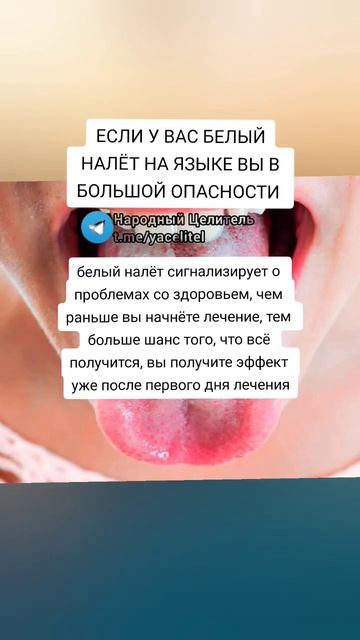 если у вас белый налет на языке, вы в большой опасности #здоровье #зож #народнаямедицина #рецепт смотреть онлайн