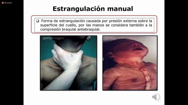 6.ASFIXIA смотреть онлайн