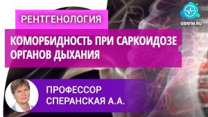 Профессор Сперанская А.А.: Лучевая диагностика коморбидной патологии при саркоидозе органов дыхания