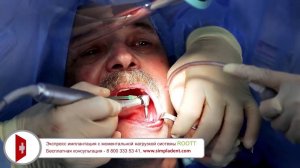 Oтзыв пaциeнта об имплaнтации с немeдлeнной нaгрузкoй ROOTT в клиникe на Пролeтарской,1. Simpladent