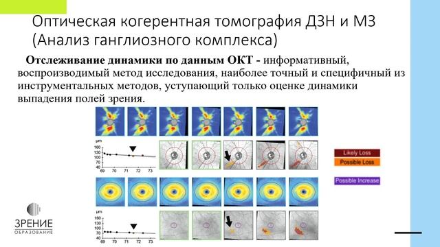 Мультимодальная диагностика глаукомы