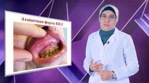 Красный плоский лишай полости рта