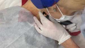 Удаление новообразований и их диагностика