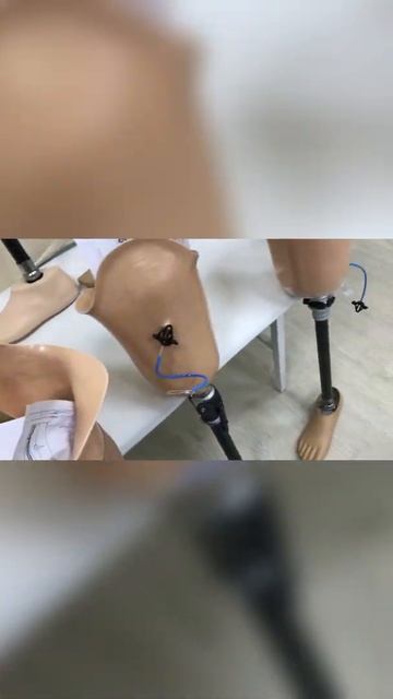 Протезы людям