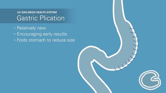 Хирургия избыточного веса. Что такое рукавная гастрэктомия смотреть онлайн