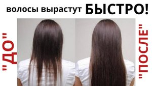 Средство от ОБЛЫСЕНИЯ и БЫСТРОГО РОСТА ВОЛОС ! Хочу густые ВОЛОСЫ!