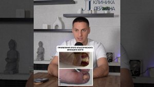 Вросший ноготь