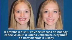 Индивидуальные элайнеры Invisalign готовы для Вашего уникального лечения  Simpladent Симпладент