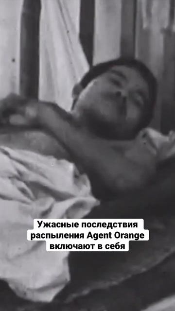 Война во Вьетнаме — стыдная страница американской истории #История #США #ВьетнамскаяВойна #shorts