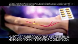 Реклама Троксевазин   Невесомость - Октябрь 2018, 10с