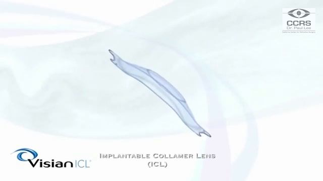 Advanced Vision Correction Technology: Exploring Bladeless LASIK, SMILE, Contoura, EVO ICL, and RLE смотреть онлайн