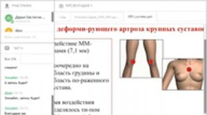 КВЧ терапия при заболеваниях суставов аппаратом СПИНОР