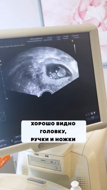 #shorts #беременность #гинеколог #планированиеребенка #гинекологмосква #репродуктолог #repro_doc