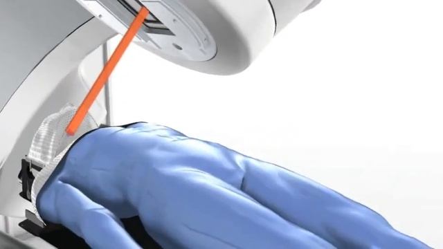 Лучевая (радиотерапия) в Израиле на TrueBeam смотреть онлайн