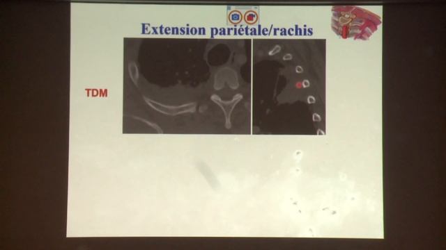 L’IRM thoracique Bases et intérêt en pathologie thoracique смотреть онлайн