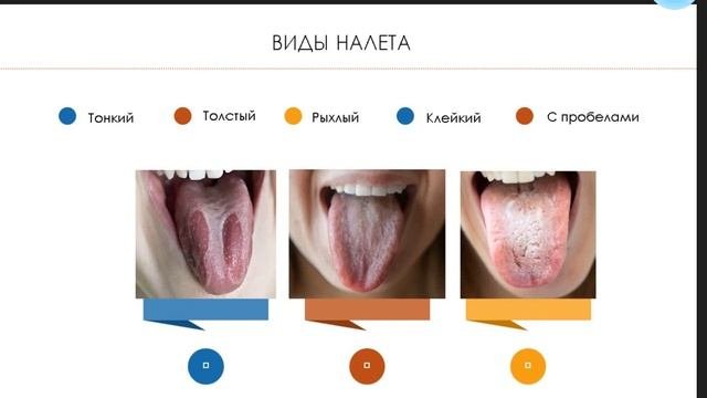 Как  понимать сигналы организма и распознавать признаки болезни по языку
