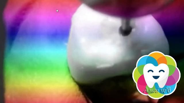 ENDODONCIA - Apertura Cameral del Primer Premolar Superior смотреть онлайн