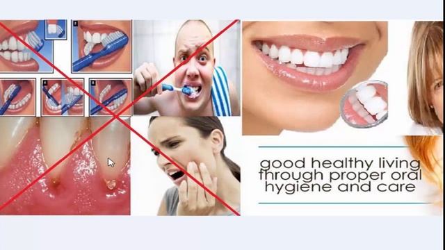 EMMI DENT I EMMI SKIN PREZENTACIJA смотреть онлайн