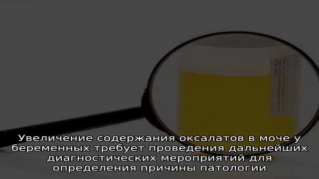 Соли оксалаты в моче при беременности смотреть онлайн
