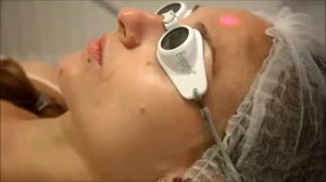 Fotona 4D - Laser Cosmetic