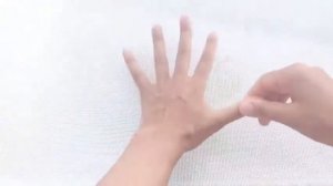 ЭТАП 1.  Реабилитация кисти. Перелом дистального отдела лучевой кости.