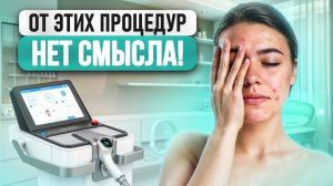 ТАКОЙ уход за лицом СТОИТ ЗАБЫТЬ! / 5 самых БЕСПОЛЕЗНЫХ процедур в КОСМЕТОЛОГИИ 2025 года!