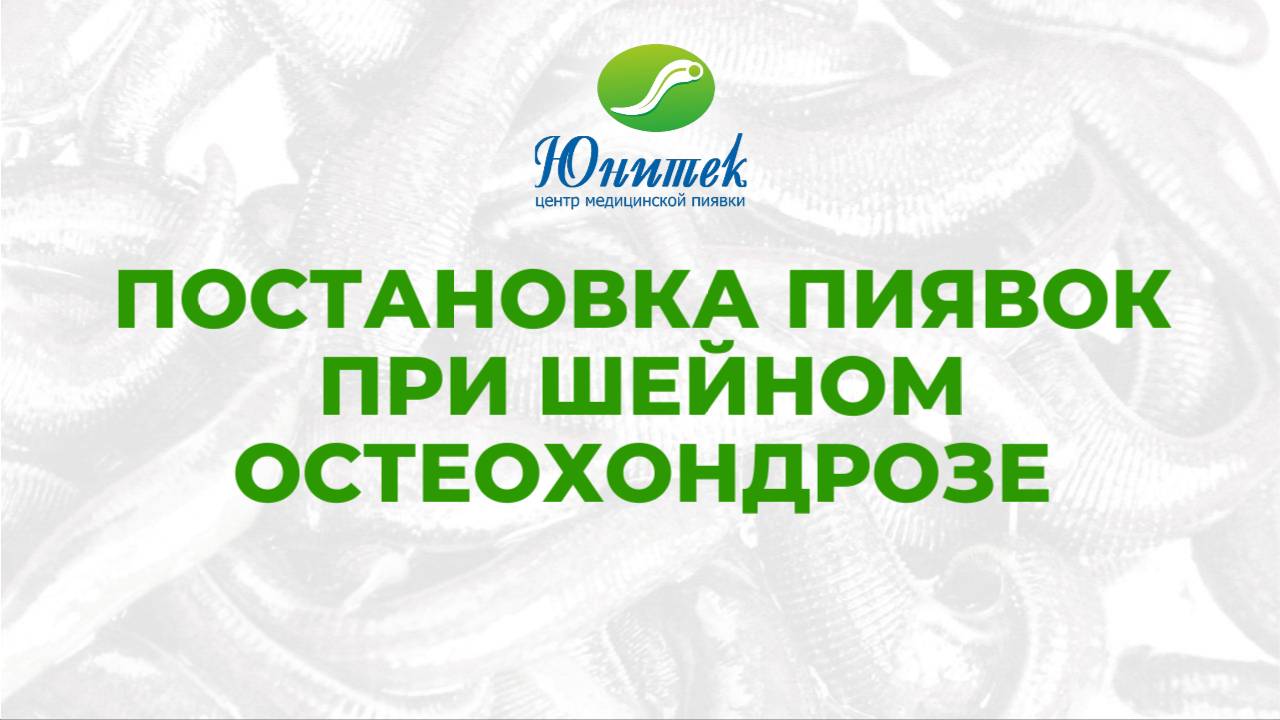 Гирудотерапия при шейном остеохондрозе