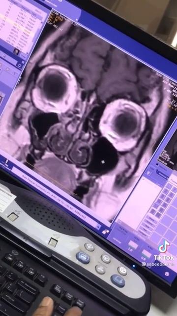 MRI #doctor #paramedical #alliedhealth #diagnosis #medical #mri #treatment
