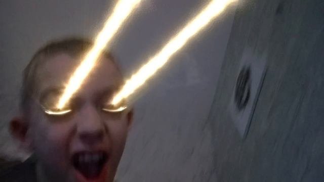 Лазеры